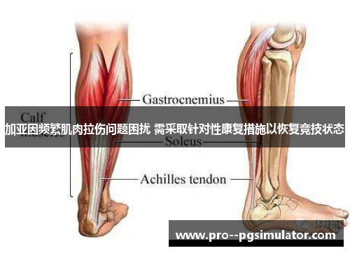 加亚因频繁肌肉拉伤问题困扰 需采取针对性康复措施以恢复竞技状态